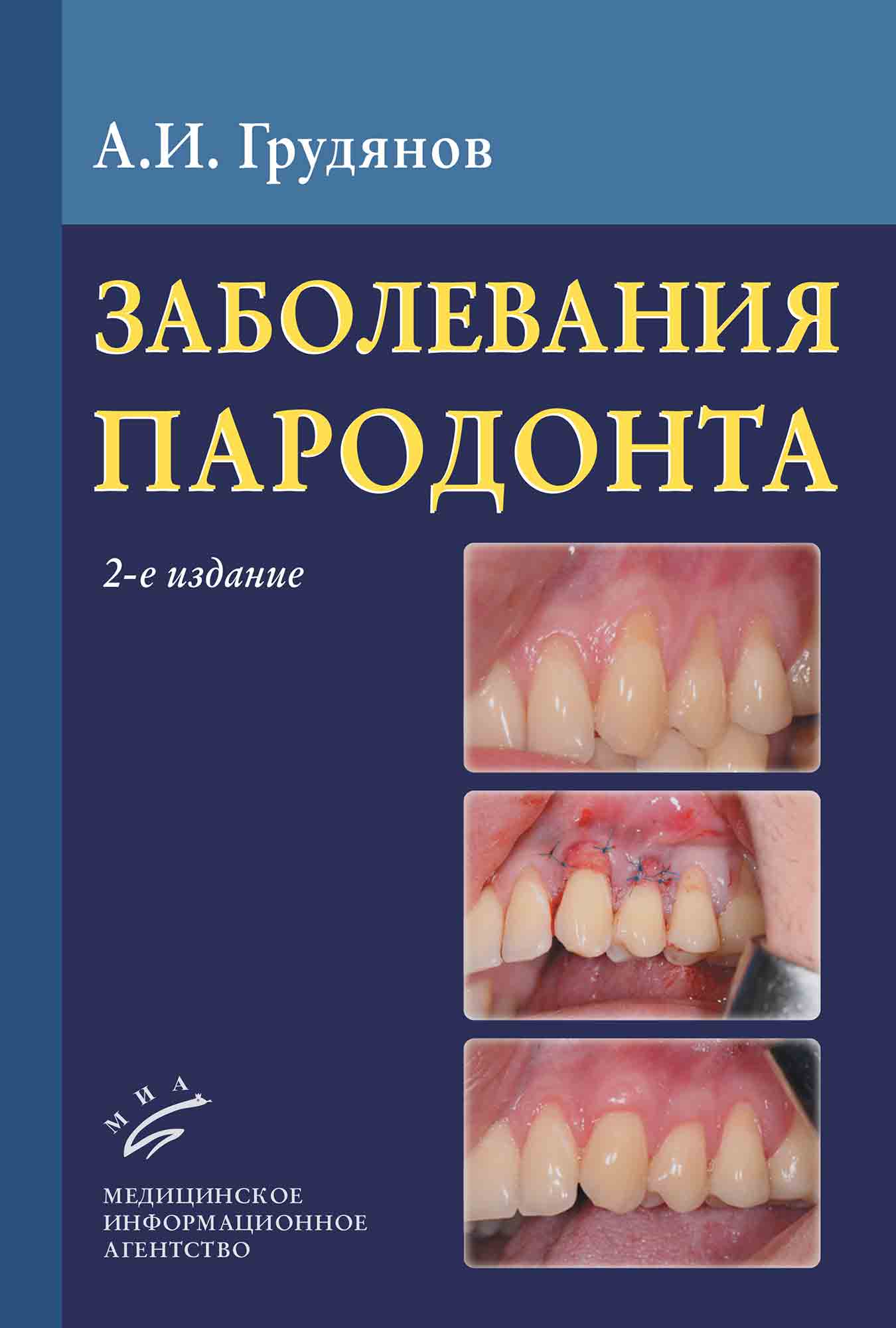 Презентация болезни пародонта